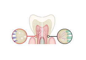 Schmerzen überempfindliche Zähne - Dr. Gordon Schroeder - Zahnarztpraxis Dr. Gordon Schroeder in Lengerich & Ladbergen